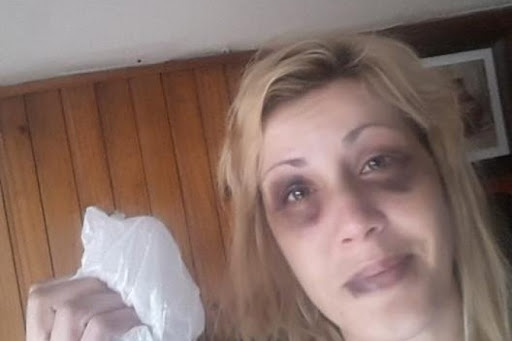 El infierno de una mujer de Pilar: la pareja la golpeó, se la llevó engañada del hospital y la tuvo cuatro días secuestrada