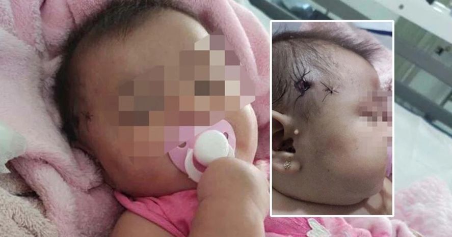 Una beba de cinco meses resultó herida en la cabeza con un perdigonazo de goma, en un operativo policial tras un hecho de inseguridaden Merlo.