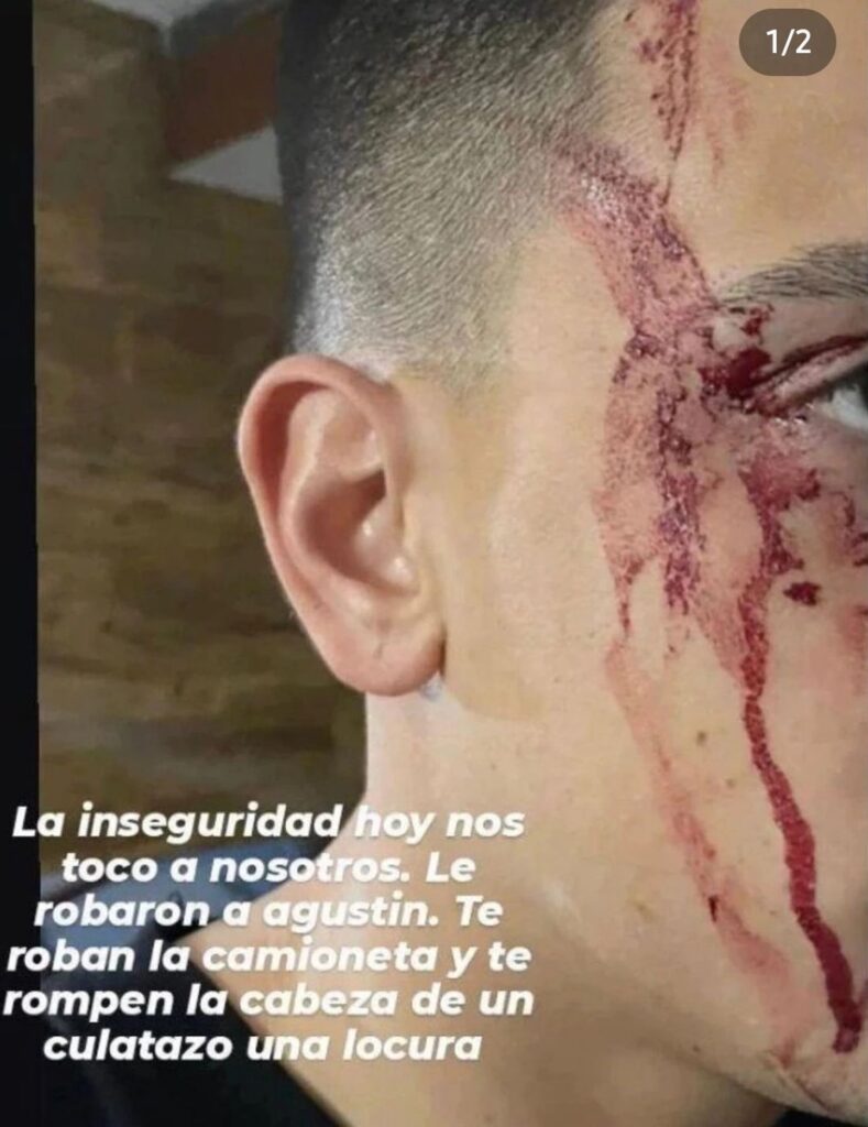 Video: así fue el violento asalto al jugador de Boca que fue golpeado por delincuentes que le robaron frente a su casa