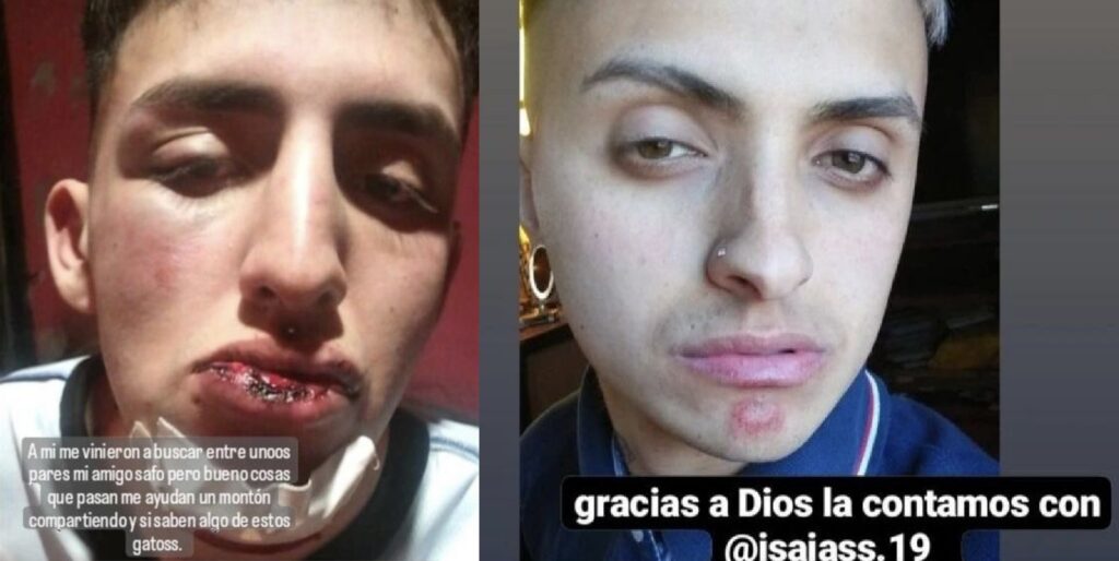 Estremecedor video en Ezpeleta: dos jóvenes sufrieron una salvaje golpiza a la salida de un boliche