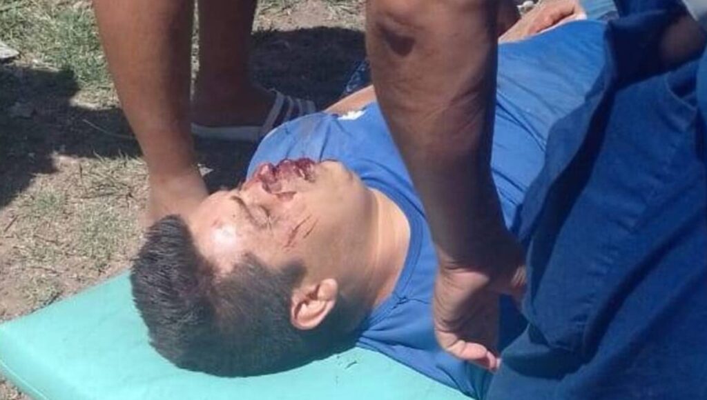 El calvario de un vecino de Moreno: lleva un mes y medio en coma tras un brutal ataque de ladrones que siguen libres