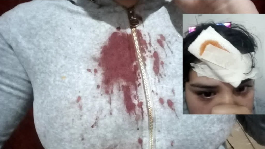 Una de las imágenes que subió a sus redes Florencia González, atacada por su pareja que le tiró un horno eléctrico por la cabeza.