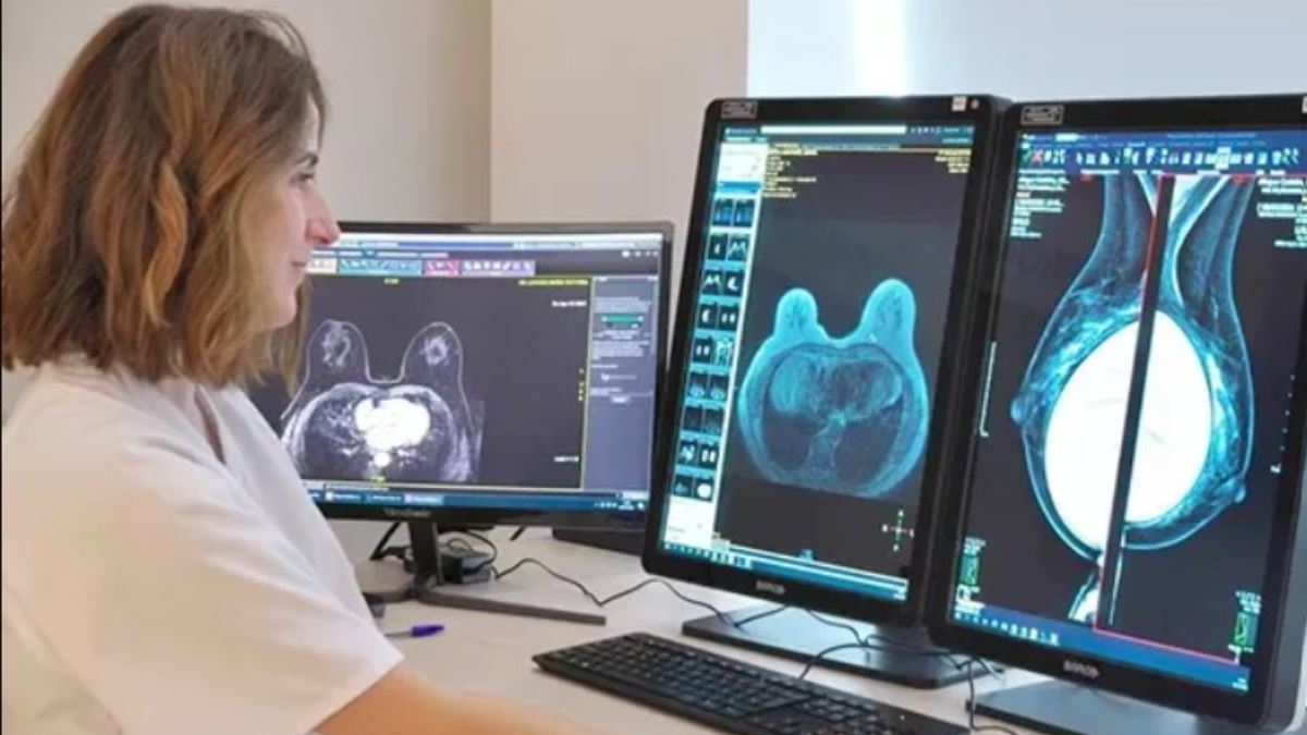LALCEC de Morón empieza a hacer mamografías gratuitas para mujeres sin obra social.