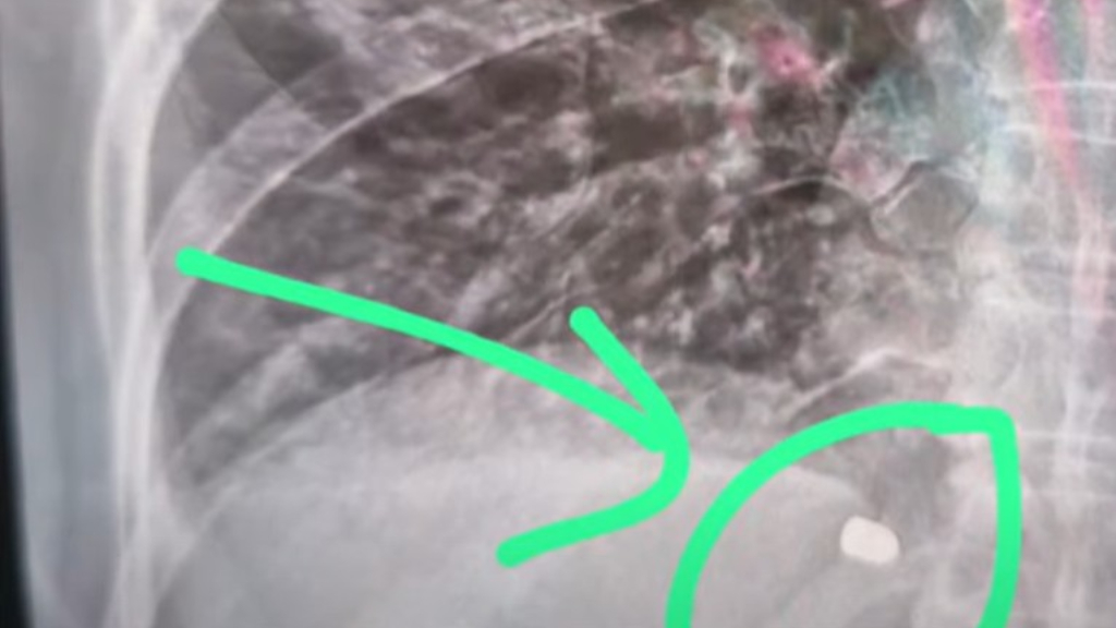 El momento en que Ana Marquis es subida a una camilla luego de ser baleada en el arroyo Correntino, en el Delta de Escobar.