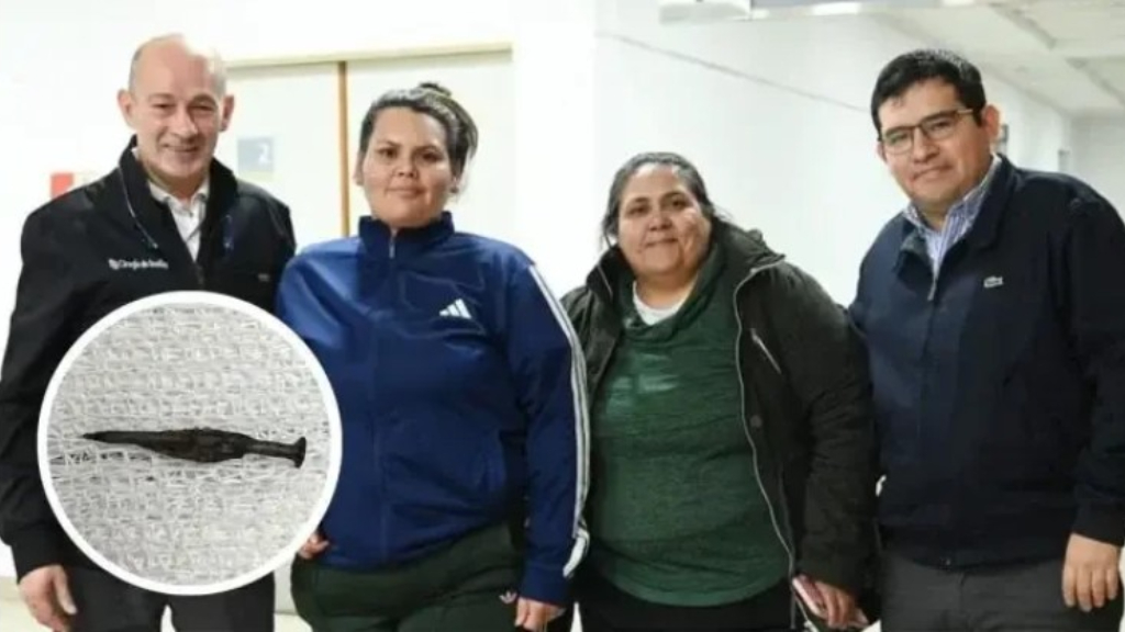 El imán que usaron los cirujanos del Hospital Materno Infantil de Tigre para extraer un clavo del estómago a un nene, protagonista de un hito médico.