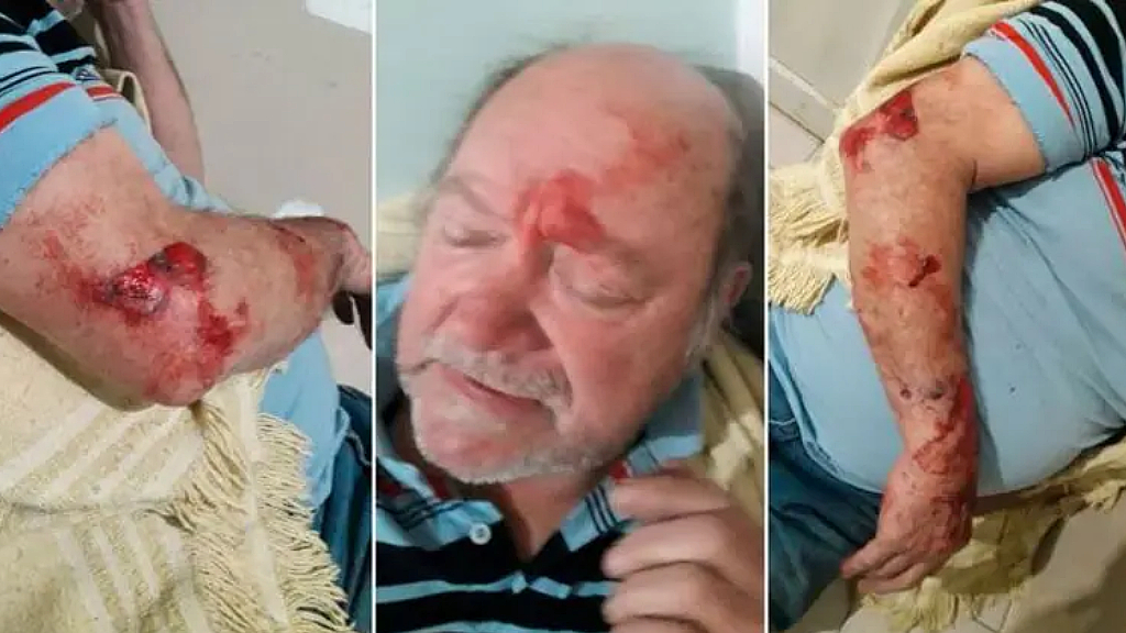 Así quedó Jorge Ríos luego del violento episodio ocurrido en 2020.